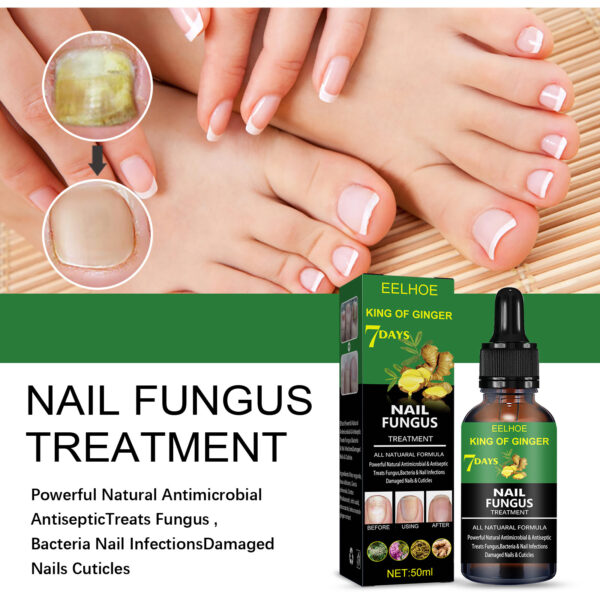 Nail Repair Solution Hand Foot And Nail Care Solution - Image 2