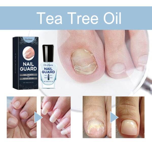 Moisturizing Nail Repair – Gentle Hand & Foot Care - Image 10