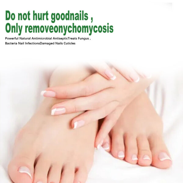 Nail Repair Solution Hand Foot And Nail Care Solution - Image 4